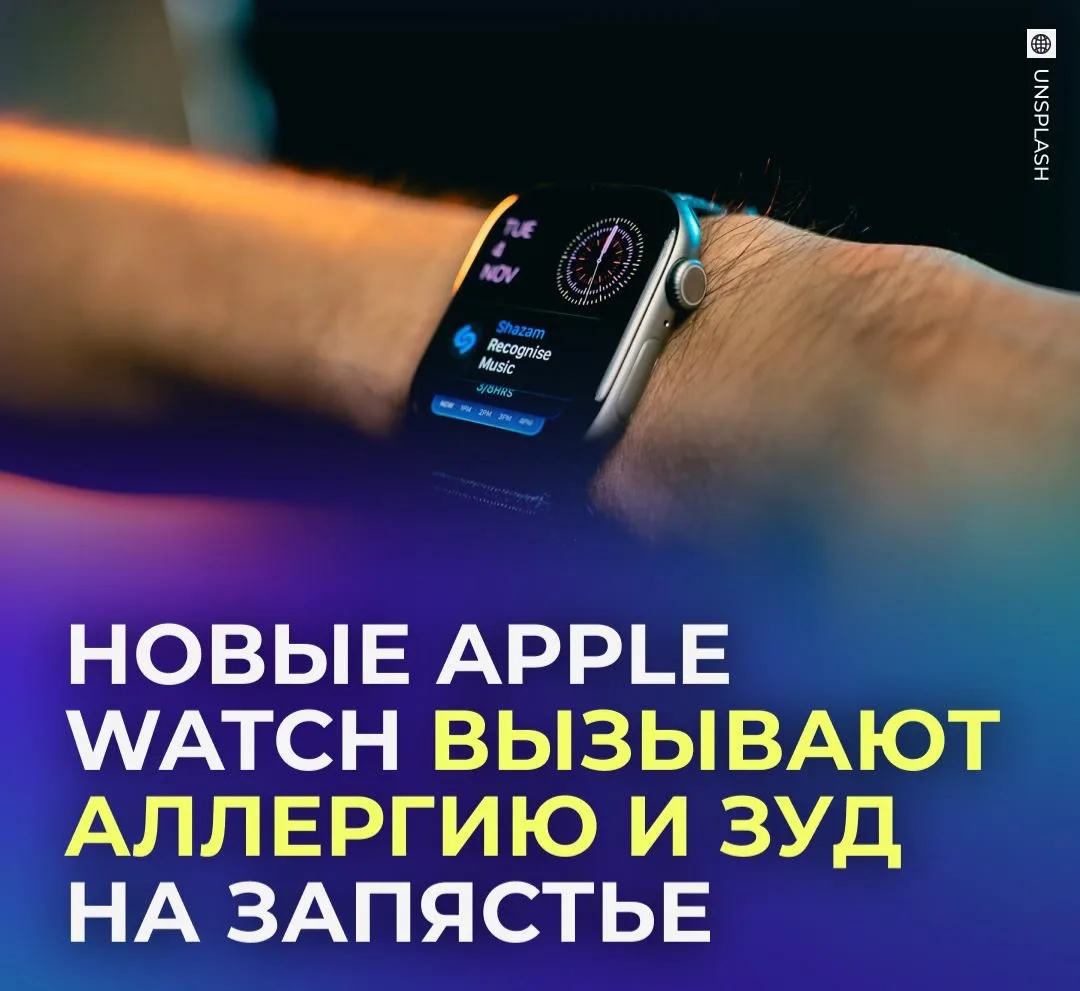 ⌚ Владельцы новых Apple Watch пожаловались на зуд из-за часов.