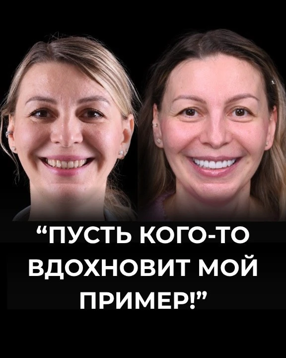 Елена пришла к нам с довольно большим количеством жалоб. Работали долго, зато как резул...