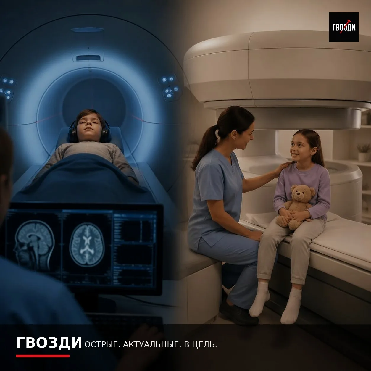 Открытый или туннельный МРТ: что влияет на качество исследования у детей
