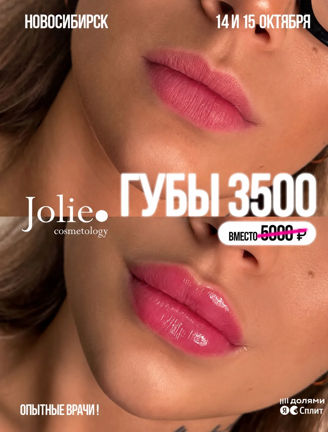 НОВОСИБИРСК, НАБИРАЕМ МОДЕЛЕЙ НА ГУБЫ ЗА 3 500 ₽! 💋🔥