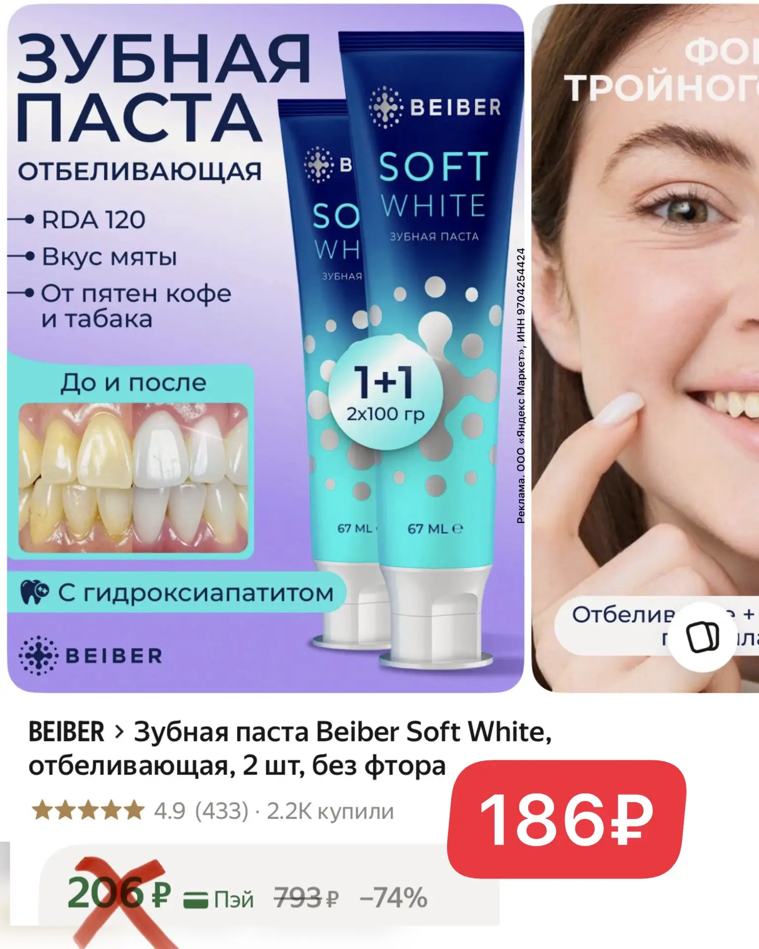 ХВАТАЕМ‼️🦷🏃‍♀️