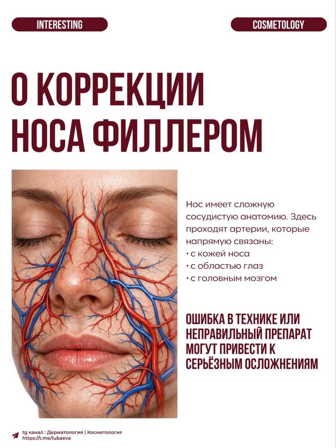 Филлеры в нос — процедура популярная, но именно она считается одной из самых рискованны...