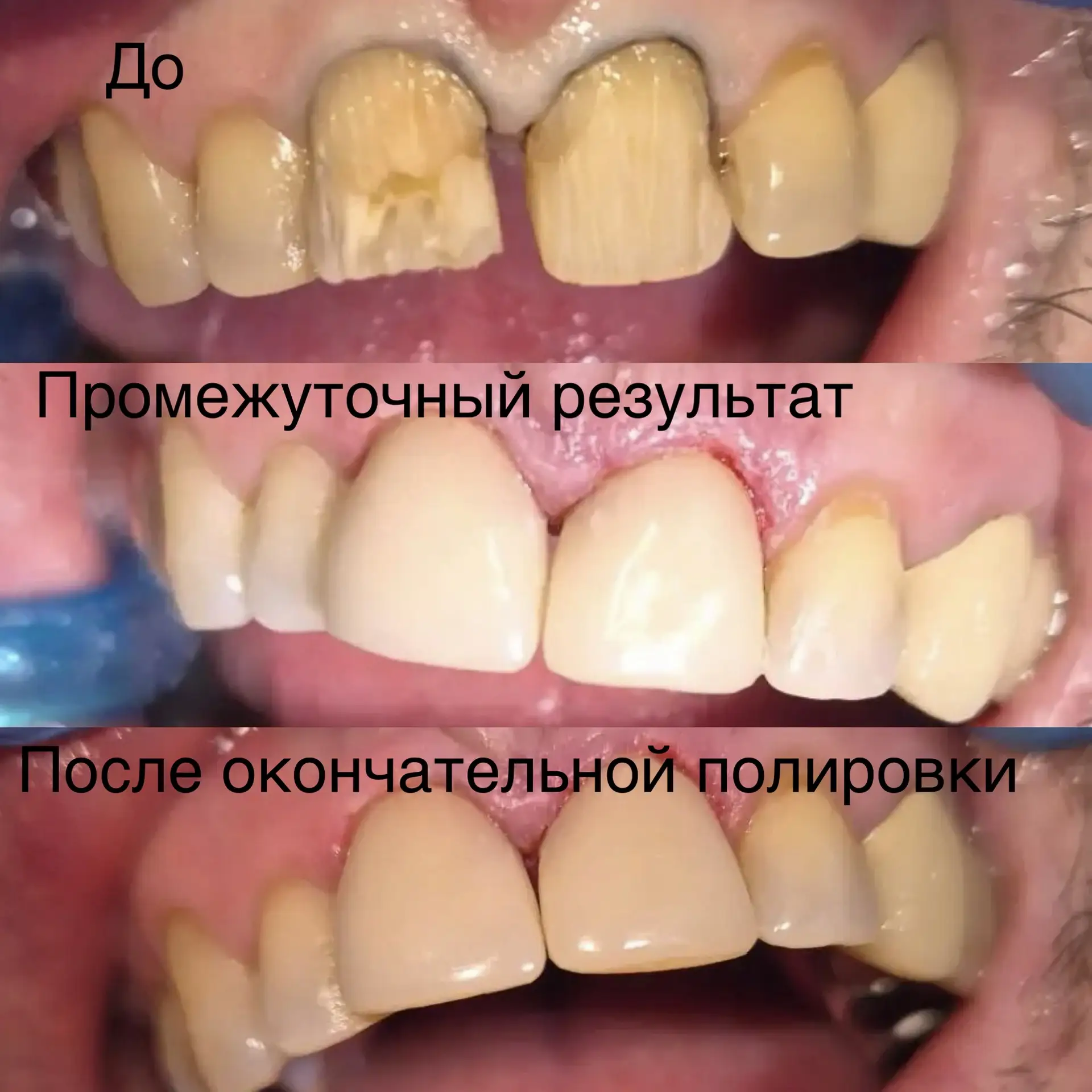 Клинический случай 🦷