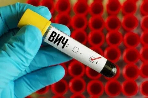 С начала года в Республике Алтай вновь выявлено 60 случаев ВИЧ-инфекции