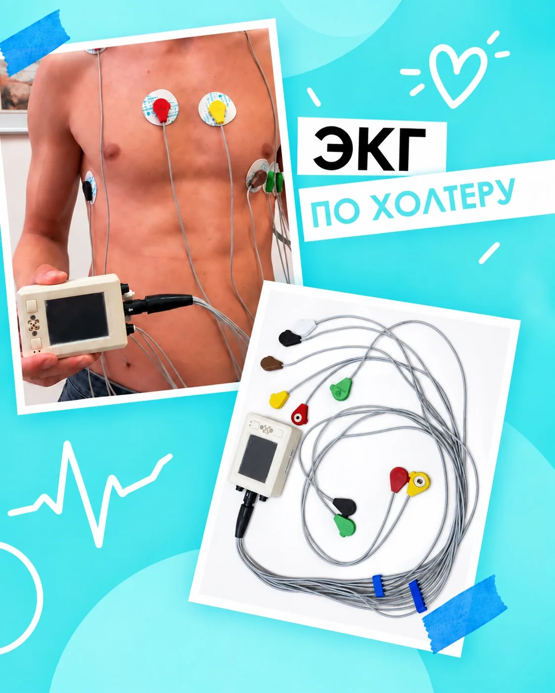 Холтер - это электрокардиограмма, но отличие во времени, в течение которого проводится ...