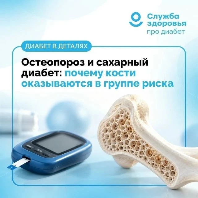 Сахарный диабет (СД) — фактор риска развития остеопороза
