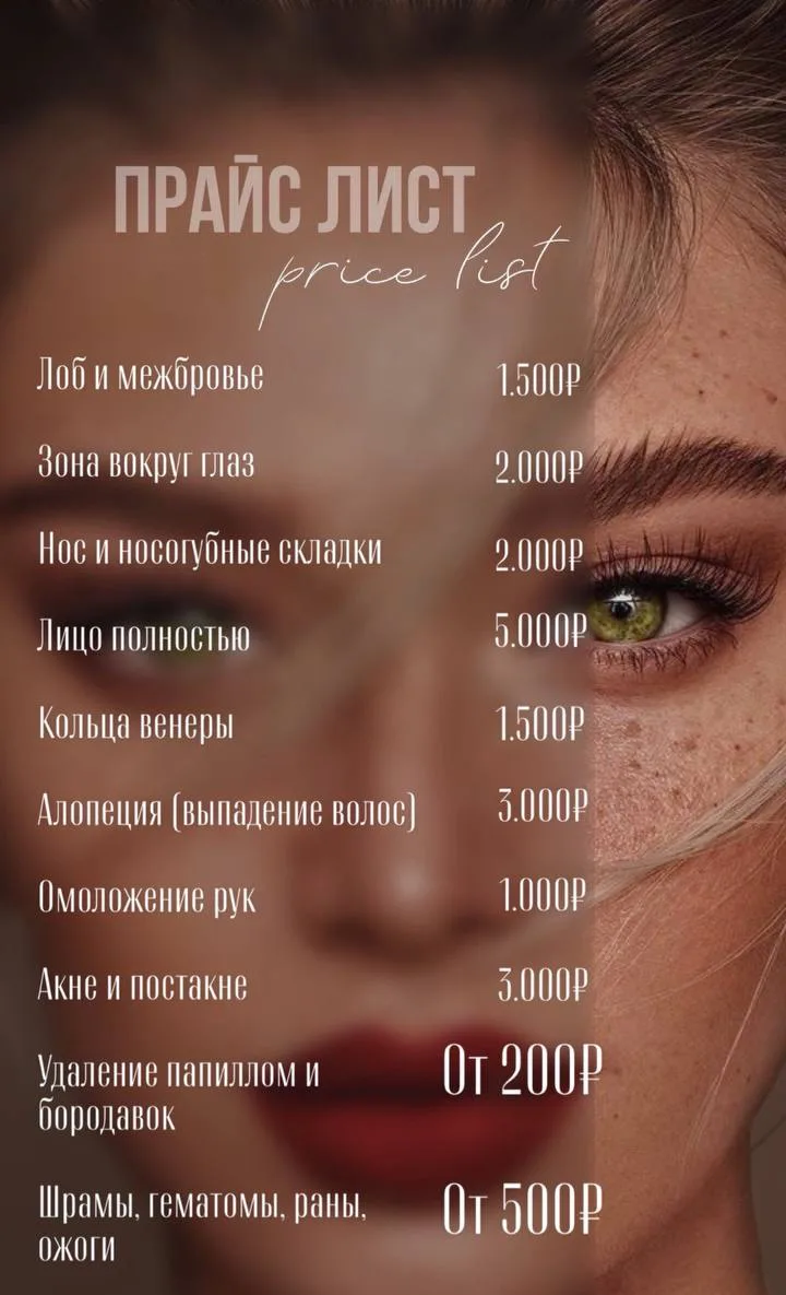 Актуальный Прайс на Холодную плазму до конца сентября. Чтобы мы могли познакомиться бли...