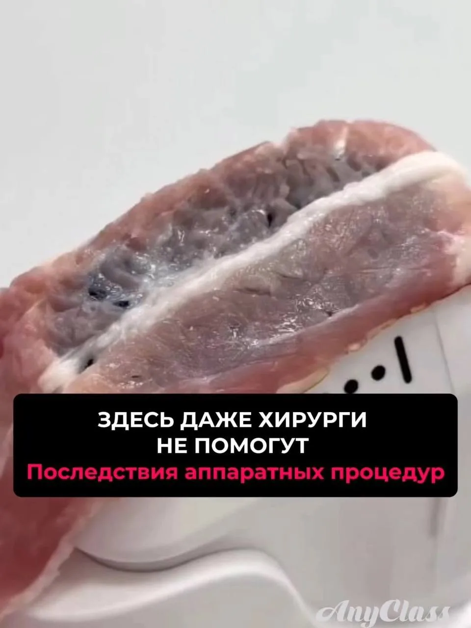 60 000 ₽ ЗА ПРОЦЕДУРУ — И ПОТОМ СНОВА ПО КРУГУ? 😳