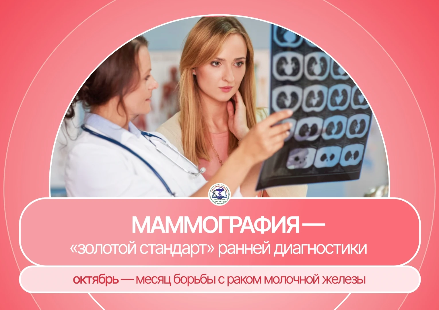 Маммография — «золотой стандарт» ранней диагностики