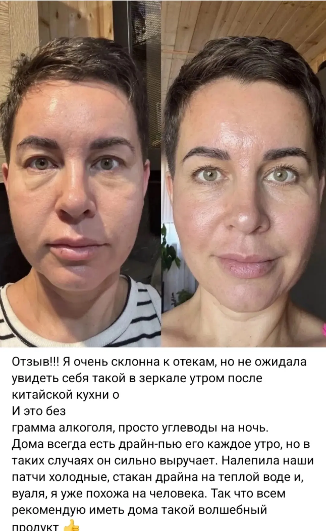 Отзыв Драйн