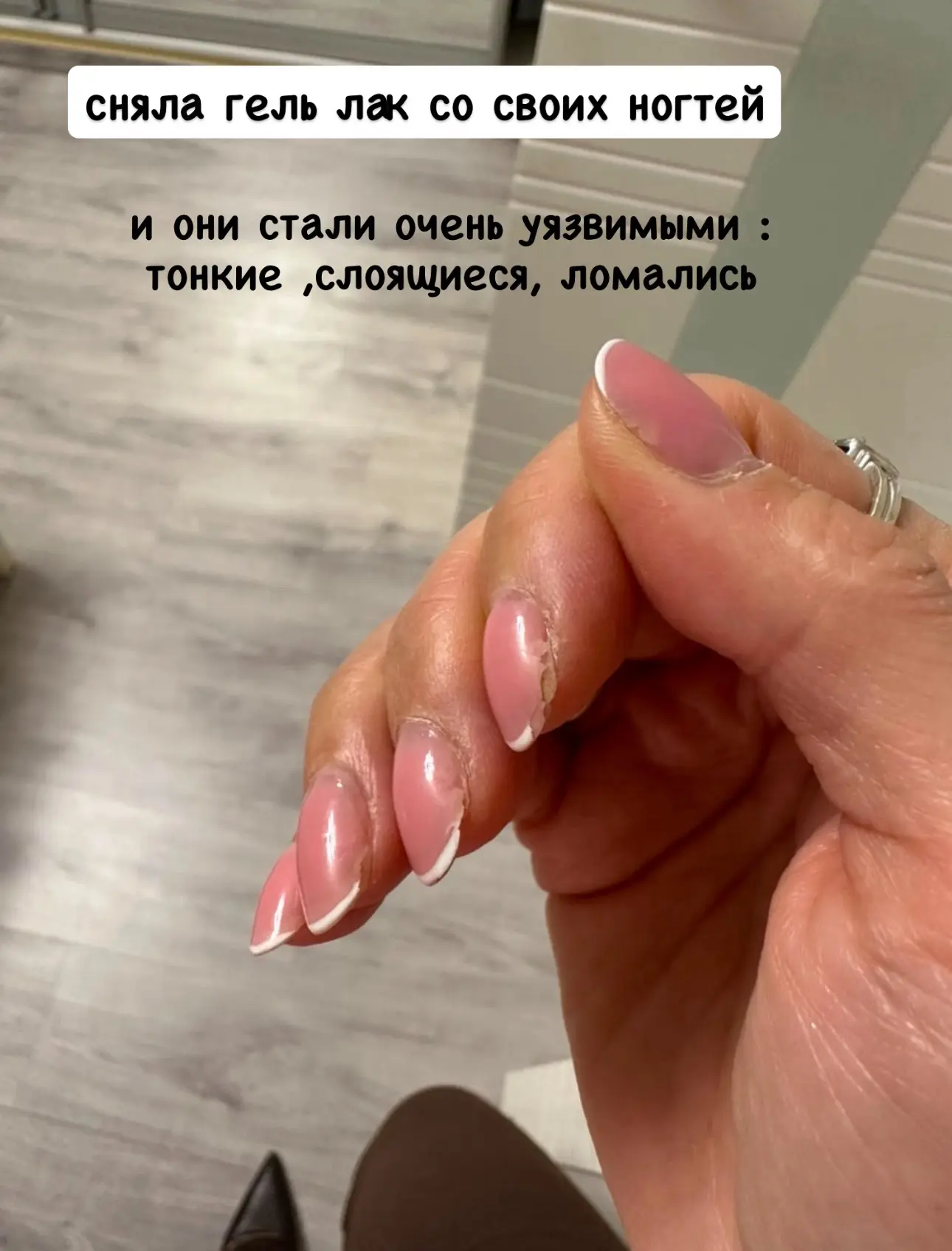 2 месяца назад я сняла гель лак со своих ногтей и они стали очень уязвимыми :тонкие ,сл...