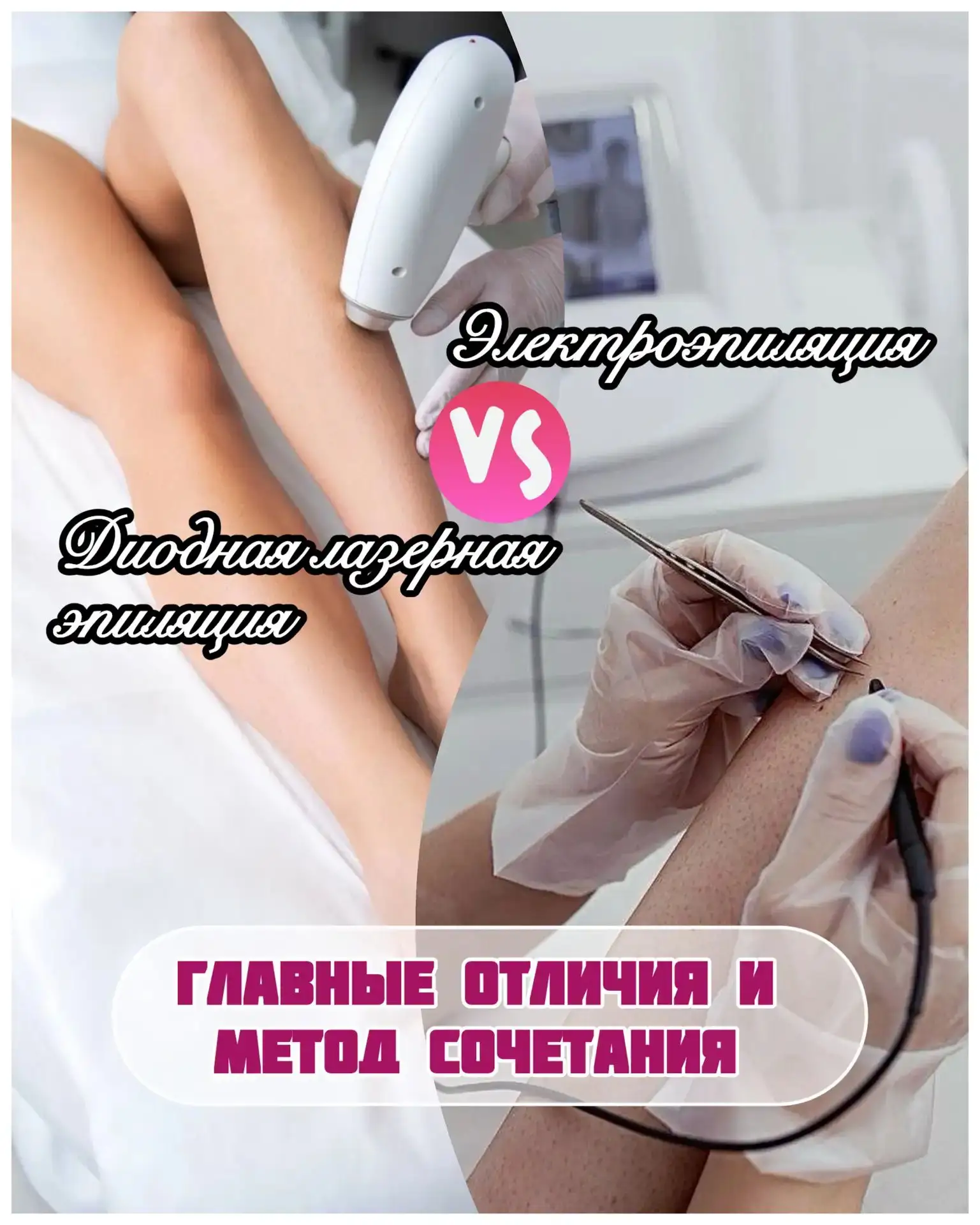 Девчонки, давайте честно про лазерную эпиляцию 💬