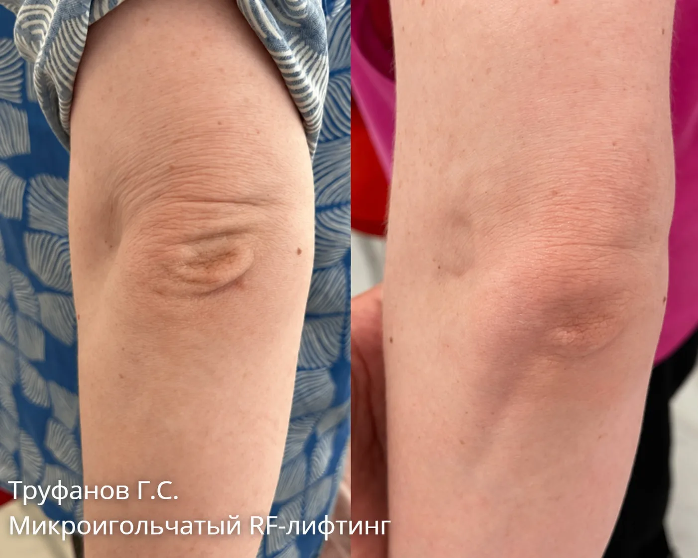 Работа врача-косметолога #арклиник