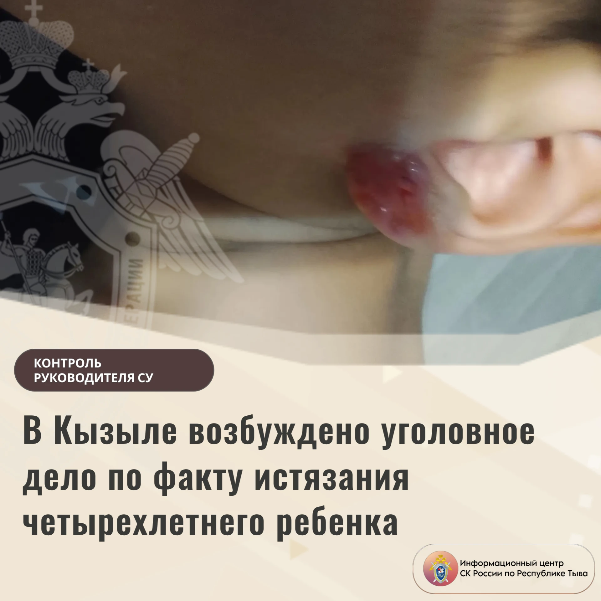 В Кызыле возбуждено уголовное дело по факту истязания четырехлетнего ребенка