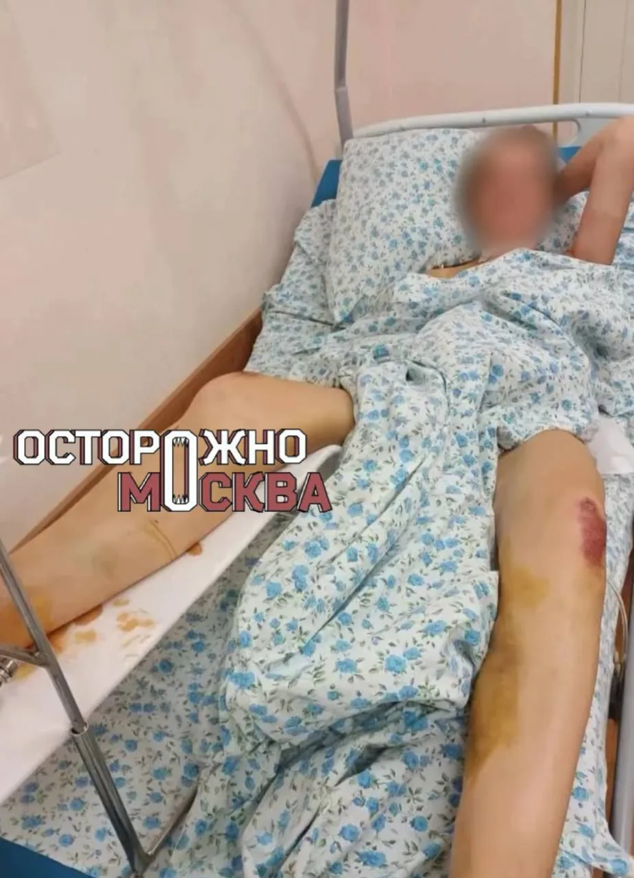 🚗 В Мытищах женщину сбили на пешеходном переходе. Она получила девять переломов и инва...