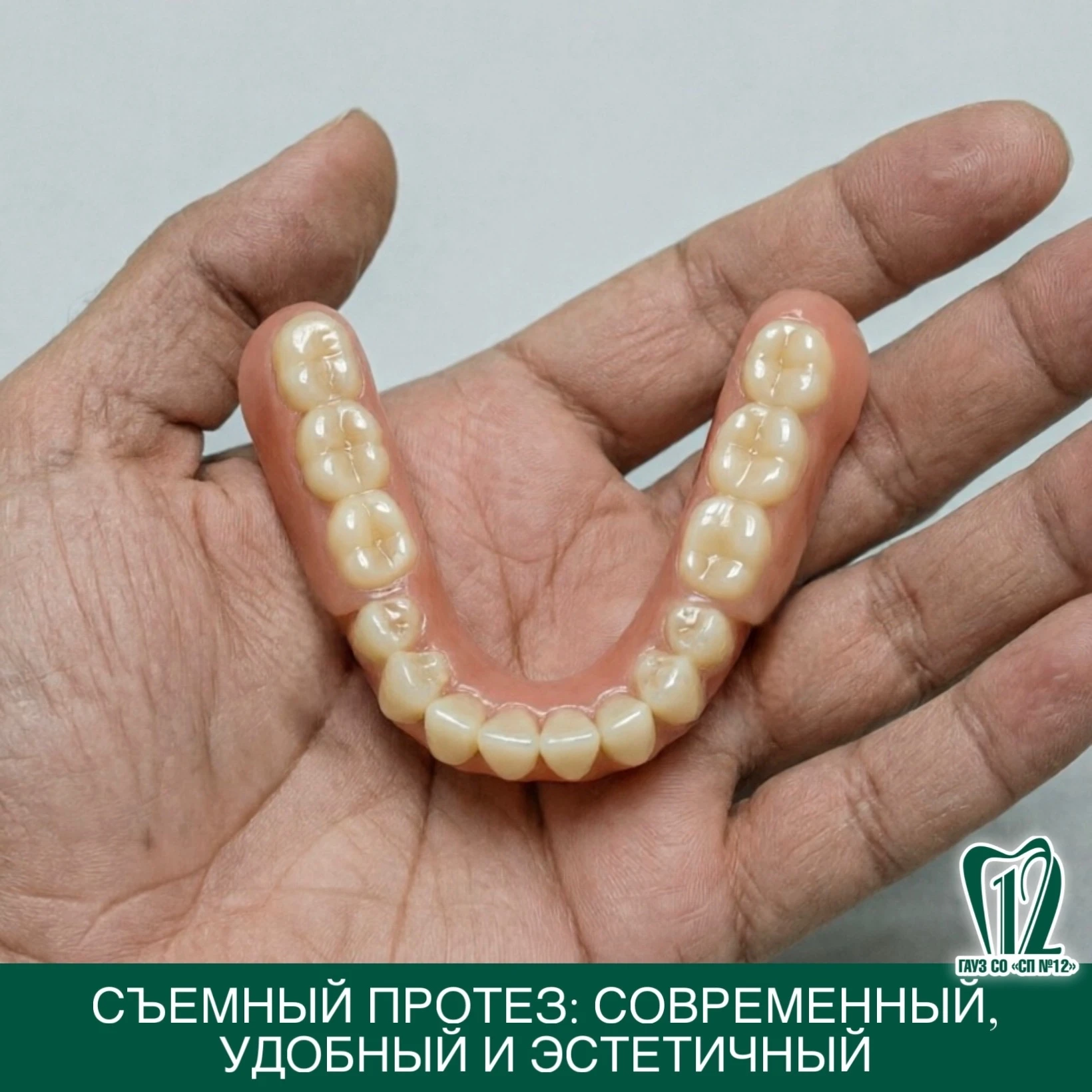 Съемный протез: современный, удобный и эстетичный.