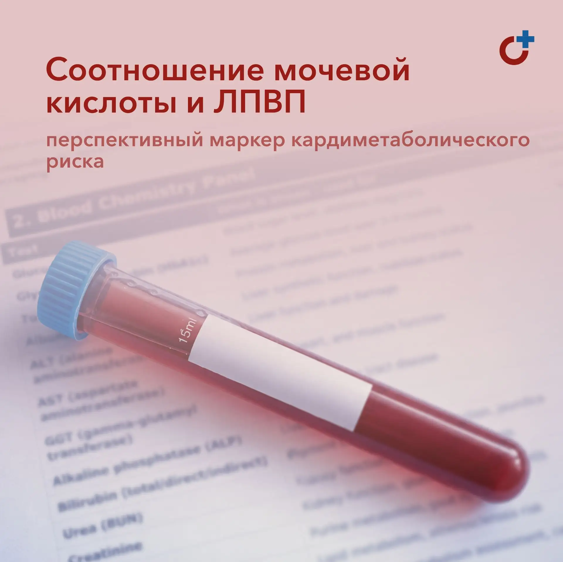 Связь показателя мочевая кислота/ЛПВП с ССЗ и дислипидемией в широкой популяции