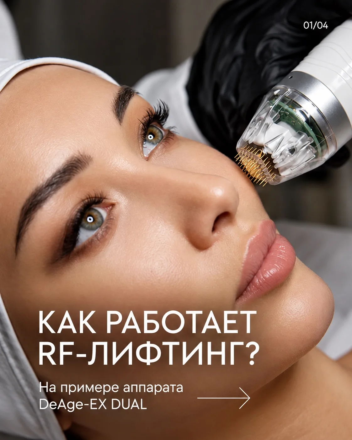⭐️Как работает RF-лифтинг?