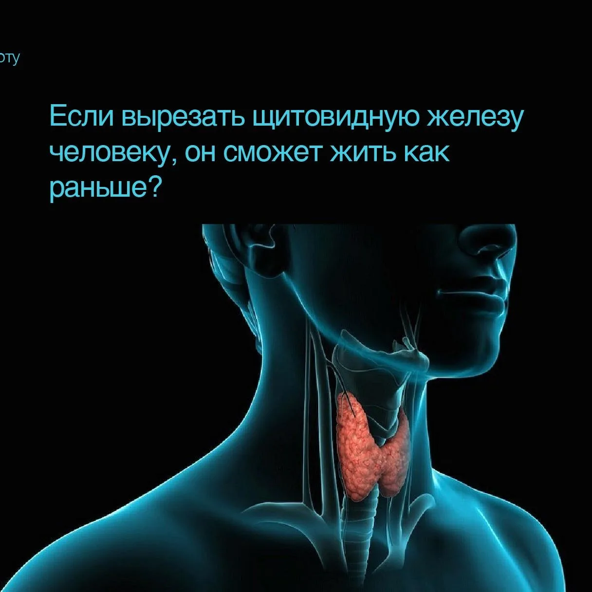 #Вопрос_эксперту: Если вырезать щитовидную железу человеку, он сможет жить как раньше?