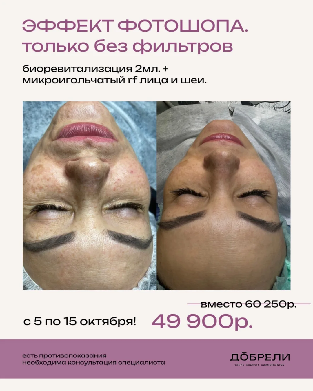 Эффект фотошопа, который не нужно выключать!