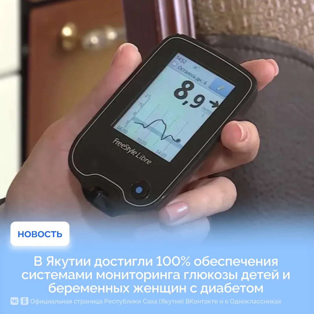 В Якутии достигли 100% обеспечения системами мониторинга глюкозы детей и беременных жен...