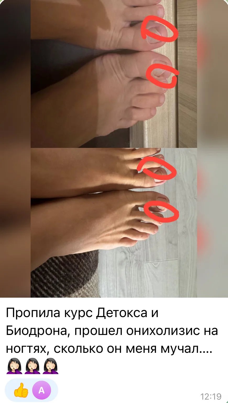 Даже в таких случаях отлично справляется ❤️‍🔥