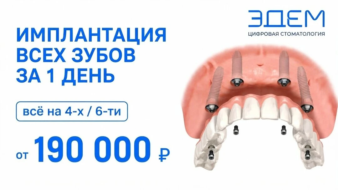 Имплантация всех зубов в Новосибирске от 190 000₽