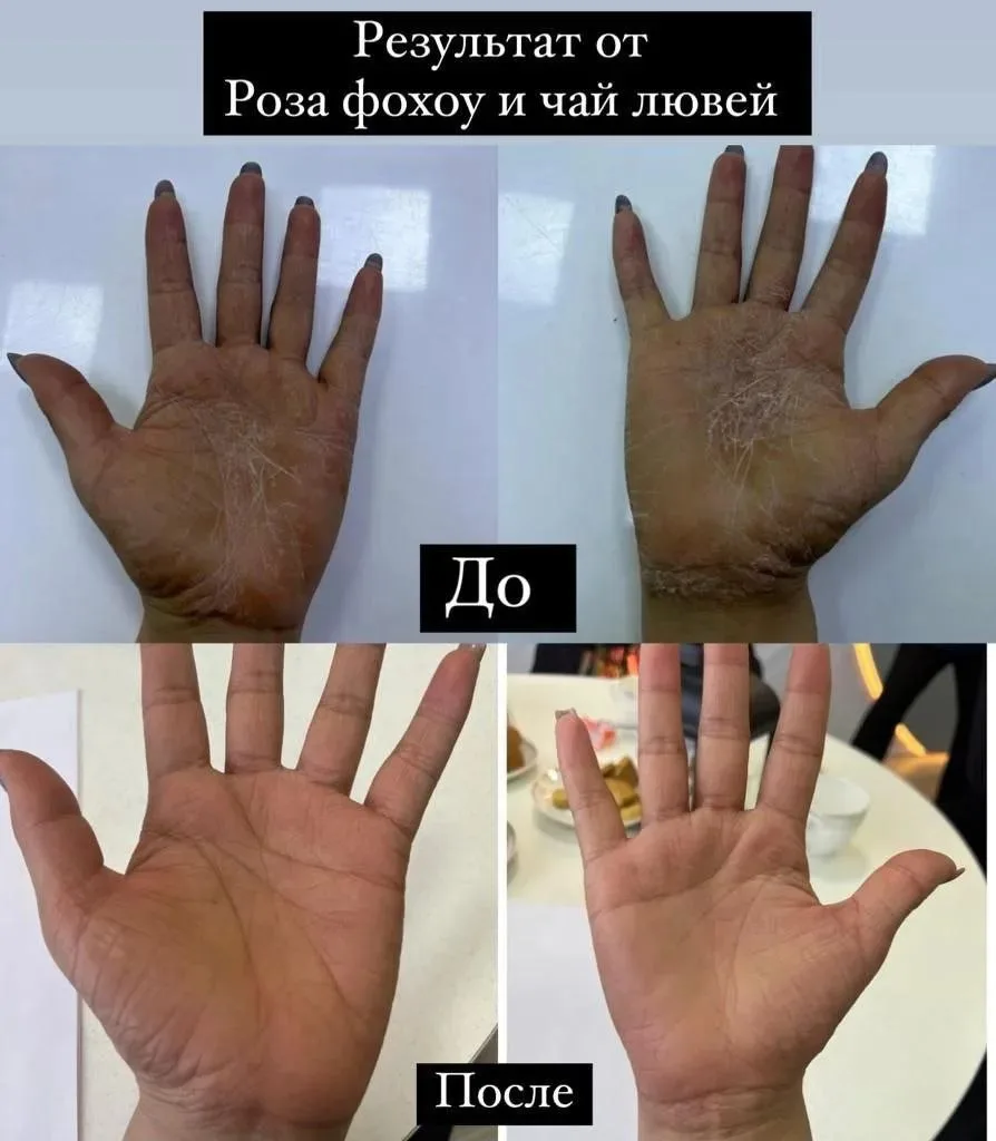 👏Отзыв об  Роза Фохоу и чай Лювей.