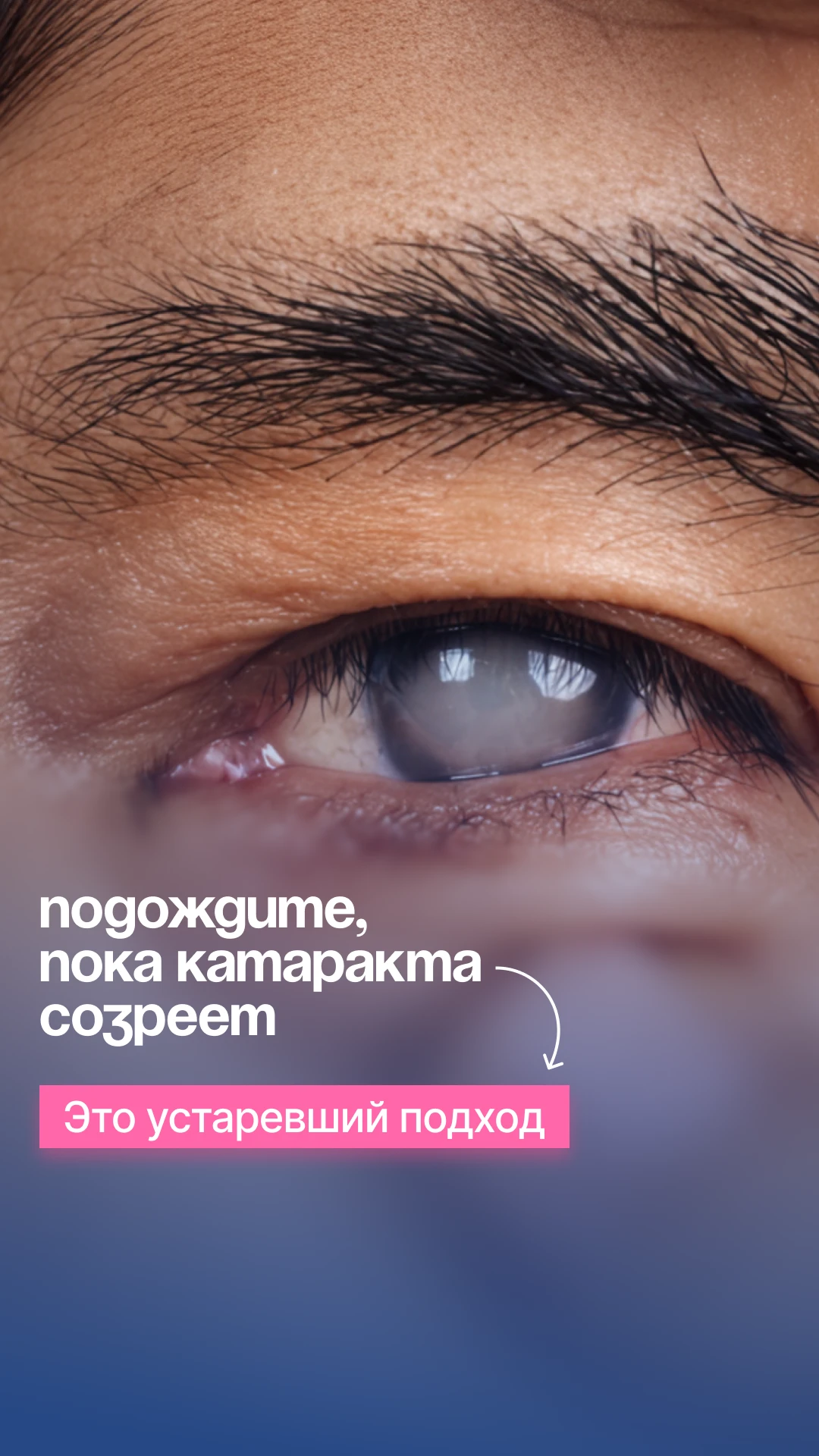 «Подождите, пока катаракта созреет» — слышали? Это устаревший совет. Объясняем в карточ...