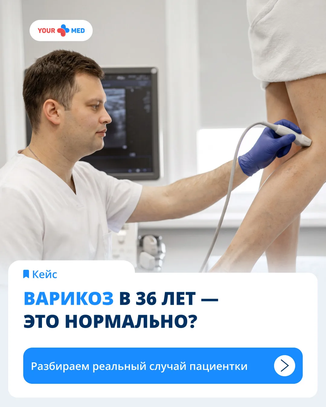 Варикоз в 36 лет — это только эстетическая проблема? Не всегда.