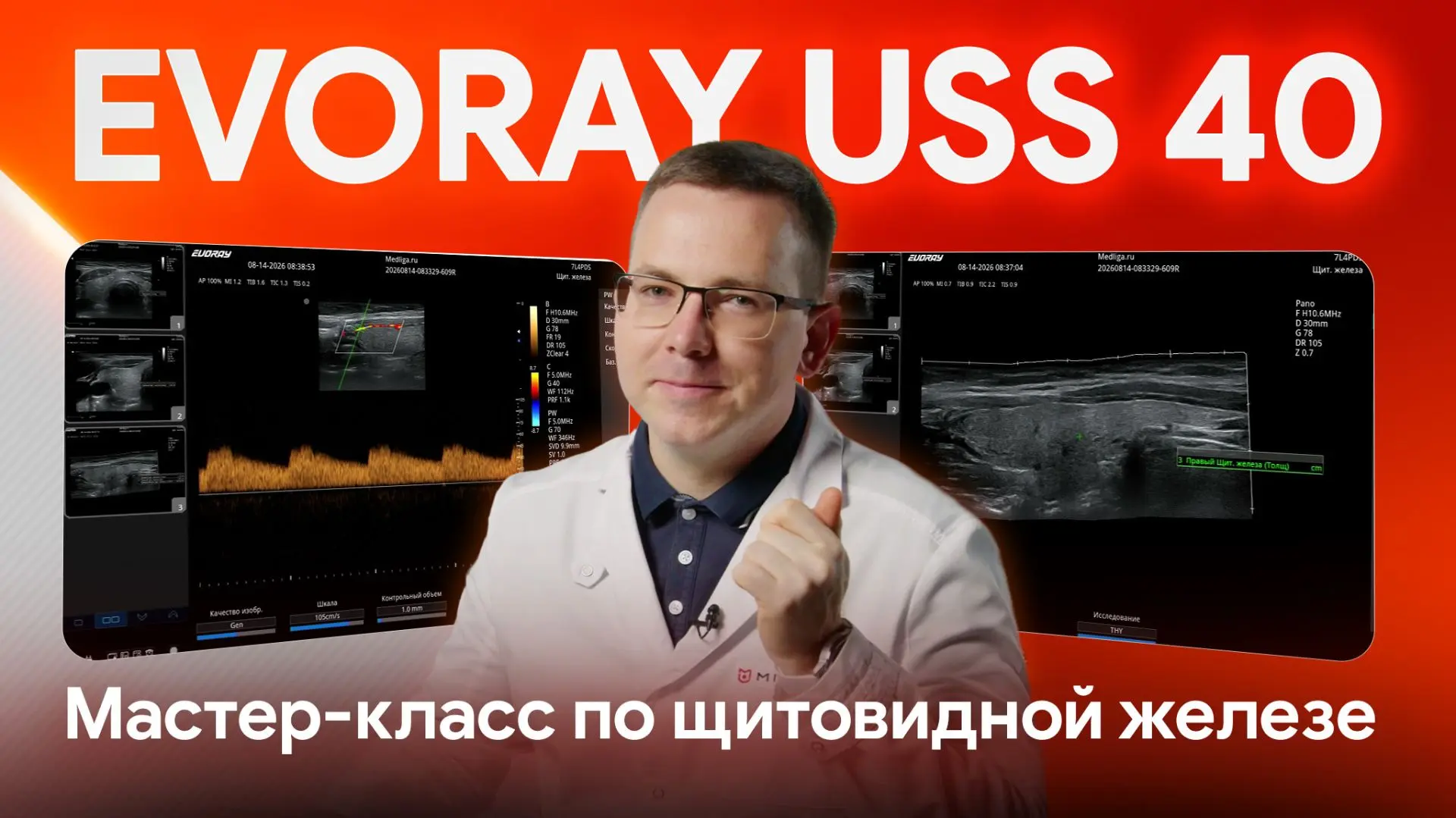 ❗️УЗИ щитовидной железы и узловых образований: что умеет EVORAY USS 40?