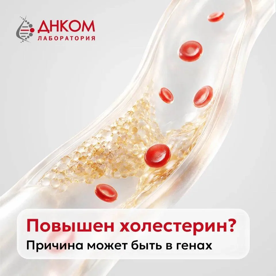 Холестерин повышен. А если причина в генах?