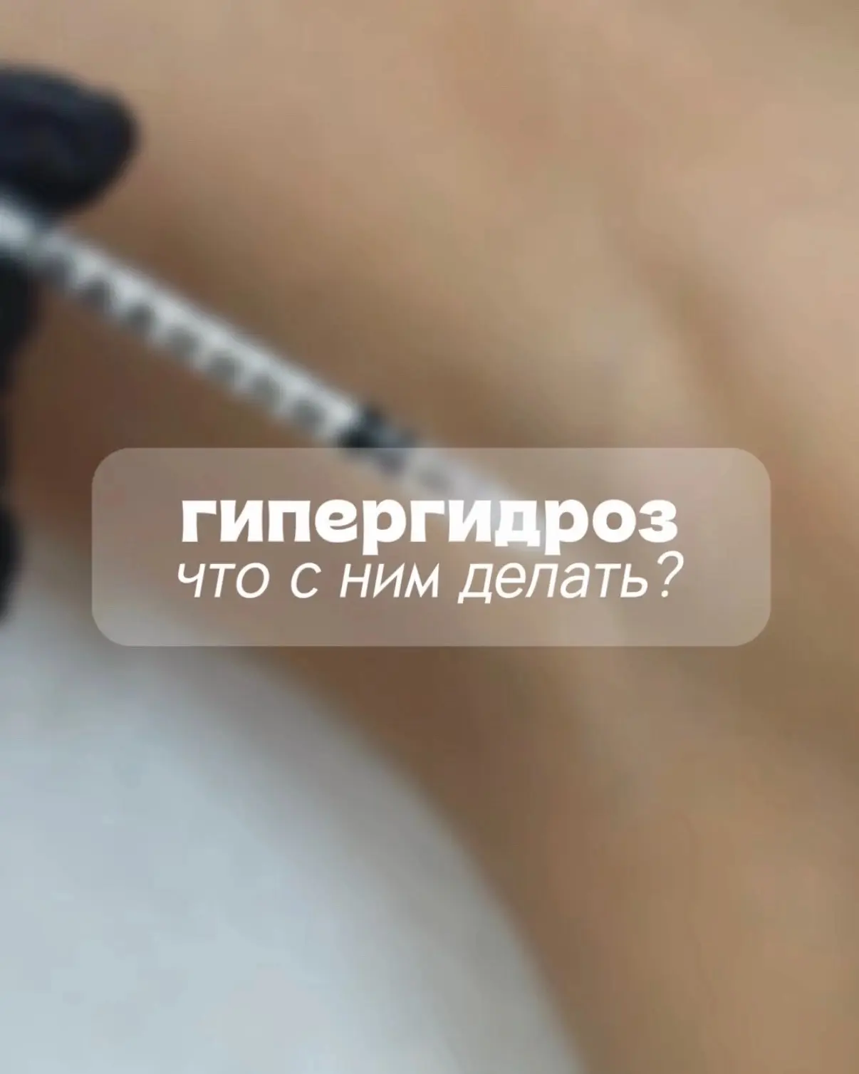 Как перестать стесняться рукопожатий и облегающей одежды?
