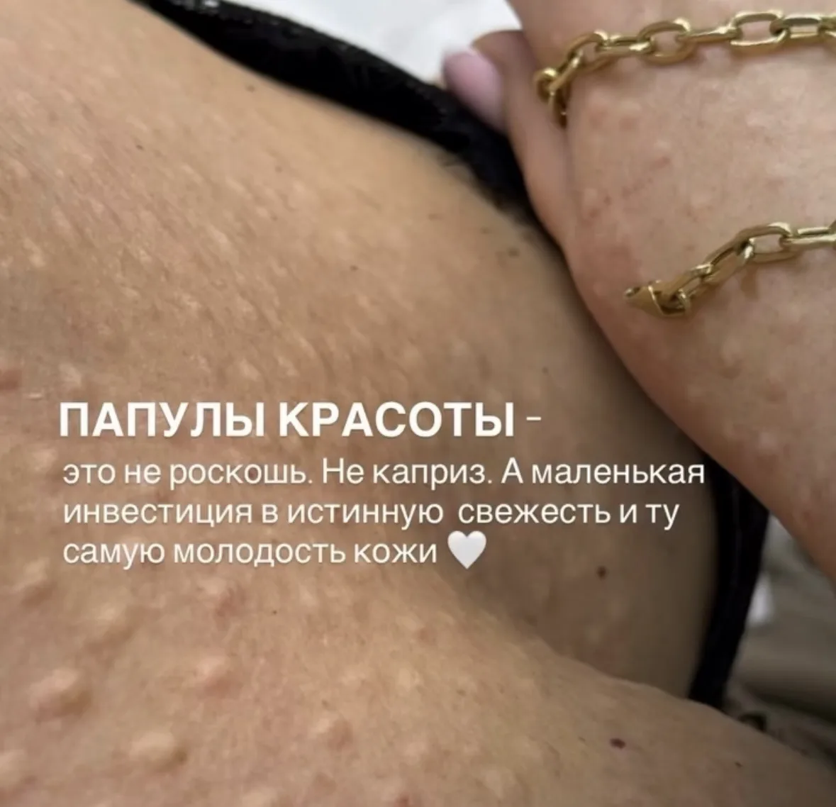 Инвестиция в кожу - это не обязательно про сложные процедуры.