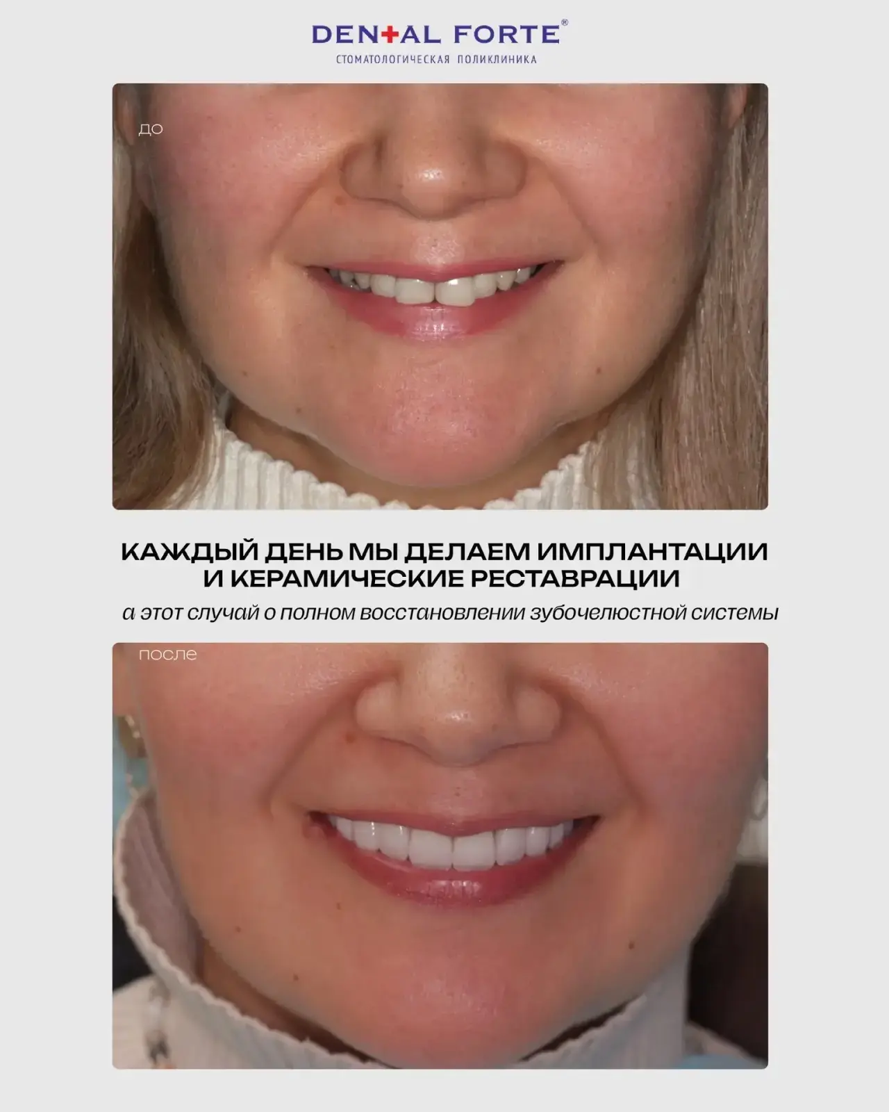 Преображаем улыбки и возвращаем здоровье в DENTAL FORTE