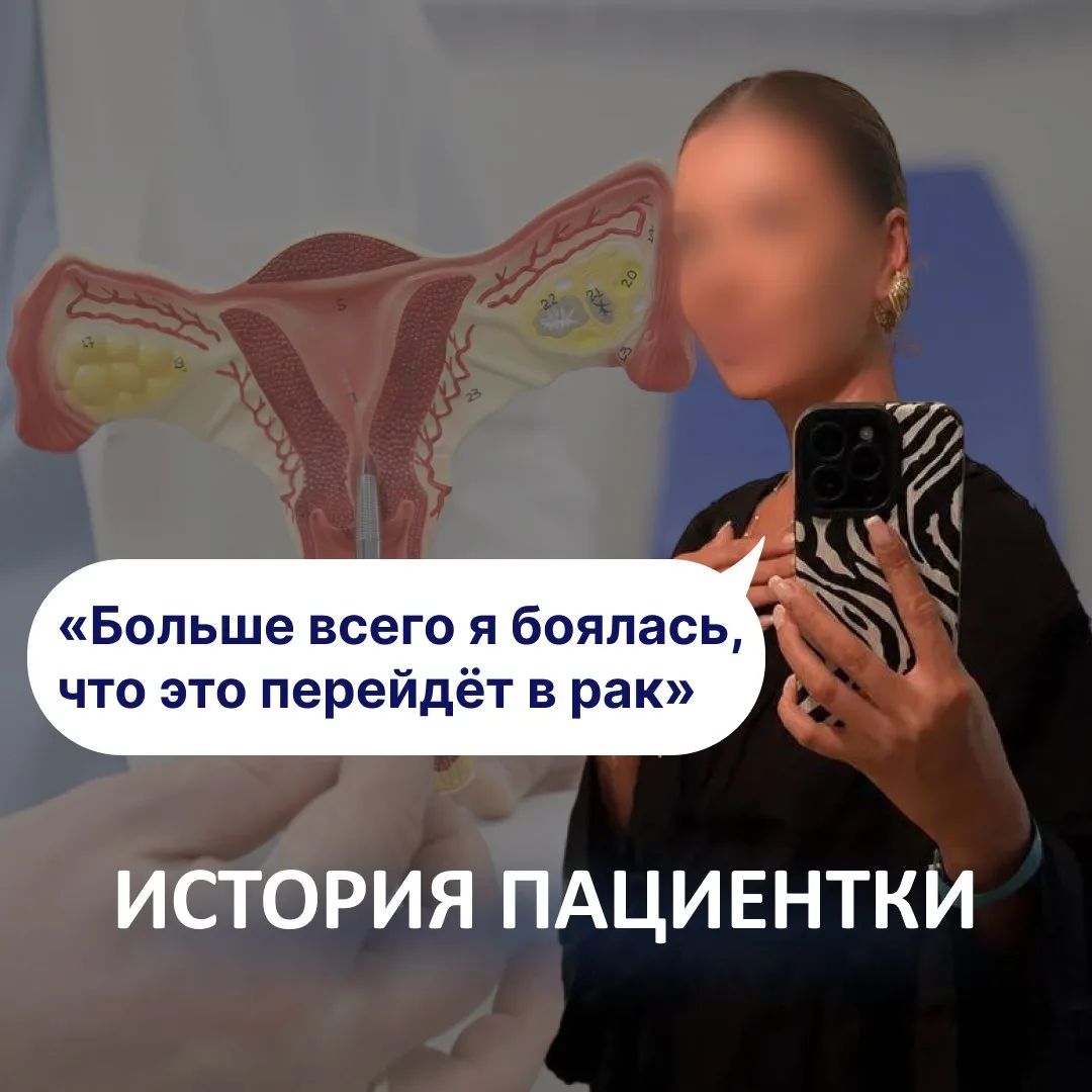 «Больше всего боялась, что это перейдёт в рак»