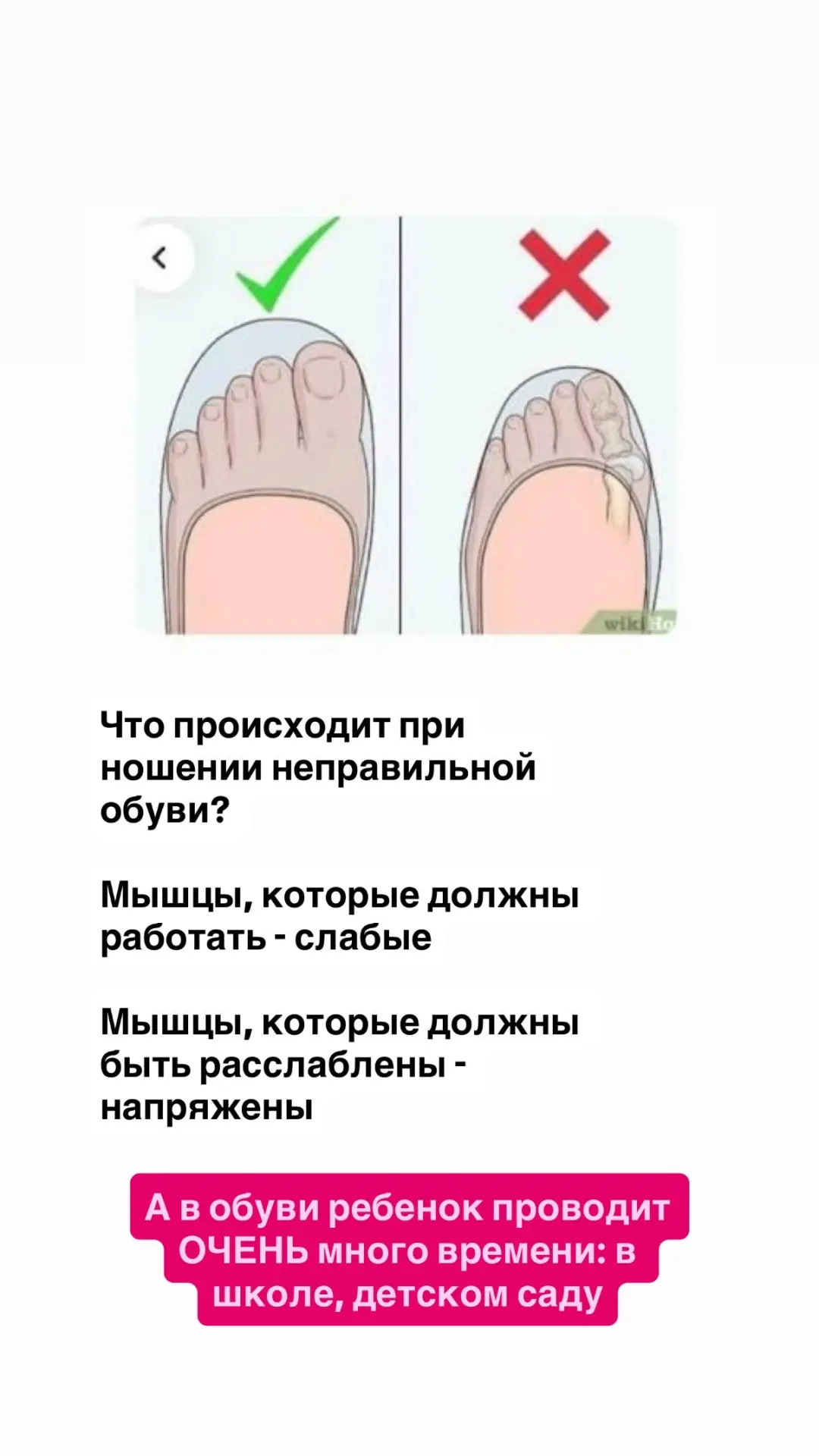КАКУЮ ОБУВЬ ВЫБИРАТЬ РЕБЁНКУ?