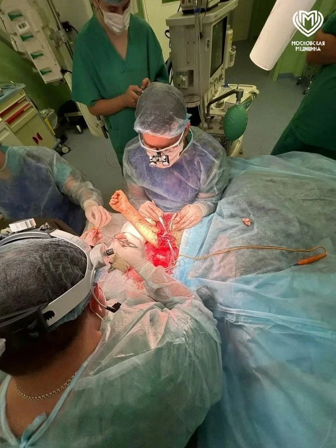 🏥 Падение с питбайка едва не стоило мальчику руки: врачи Москвы спасли 9-летнего ребён...