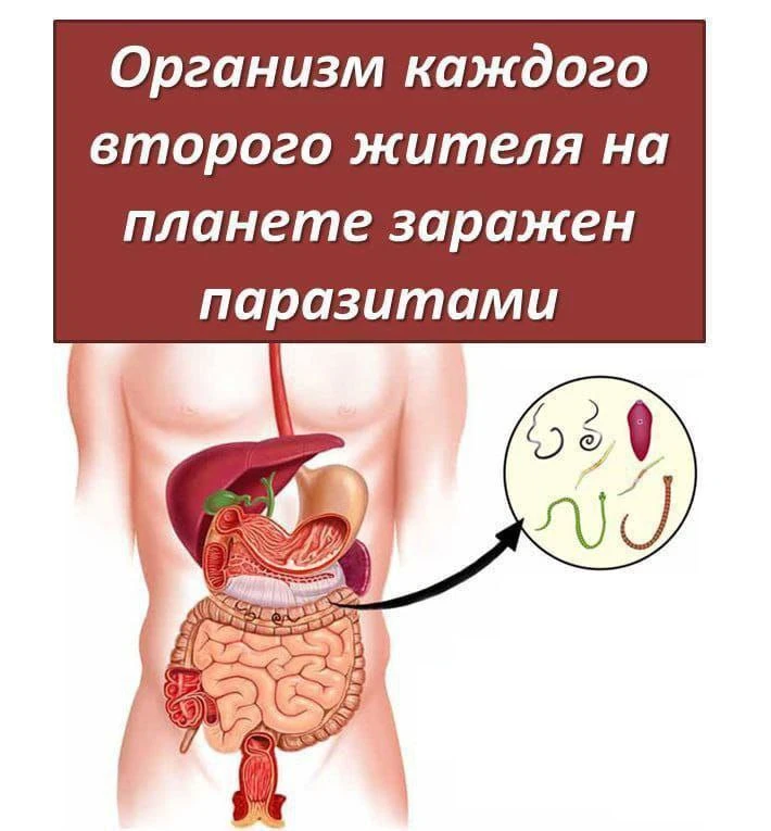 Думаете, что паразиты — это не про вас?