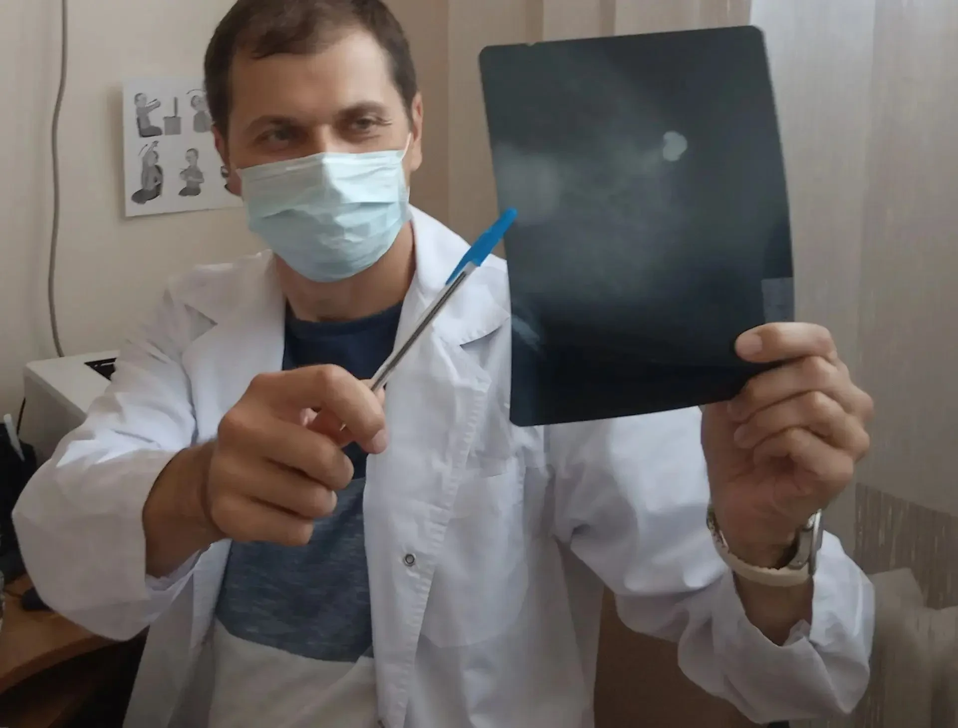 🩺 Онкологи удалили опухоль груди и сохранили имплант