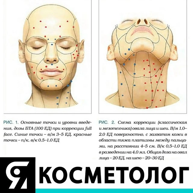 Схема современной базовой коррекции лица full face (рис. 1, 2)