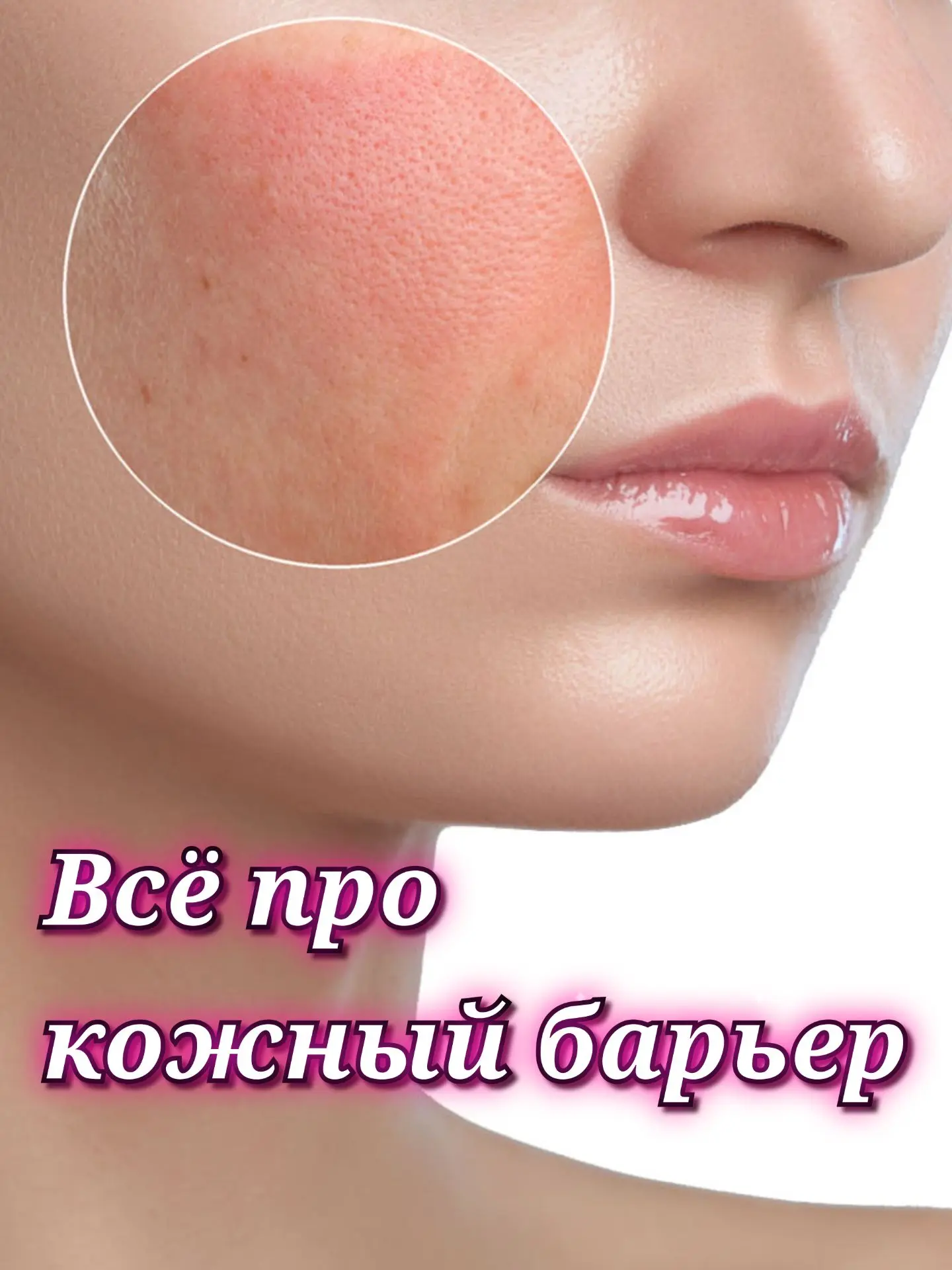 🔎 Кожный барьер: почему кожа может краснеть и щипать даже от воды? И что с этим делать?!