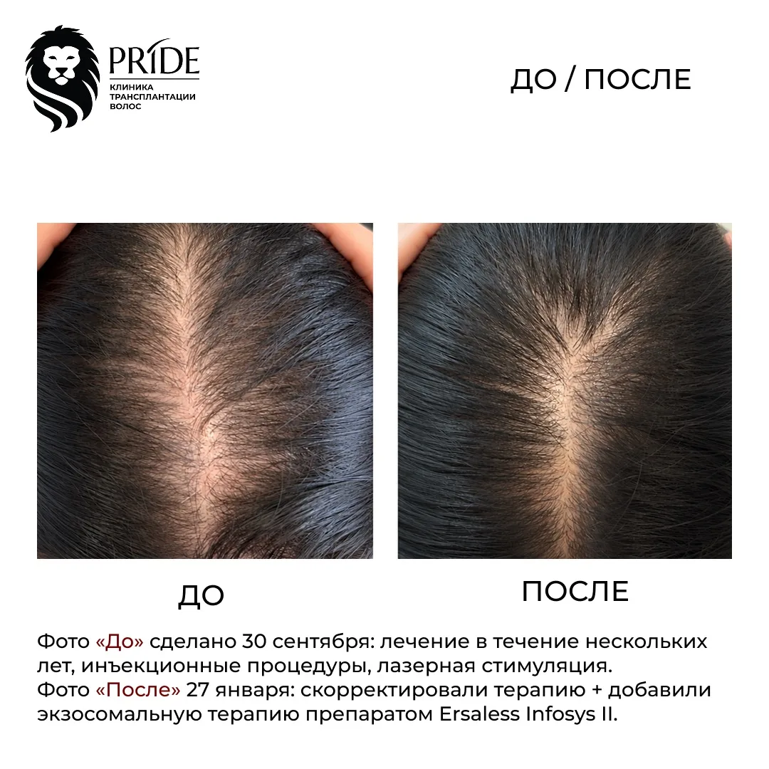 Результат, который говорит сам за себя