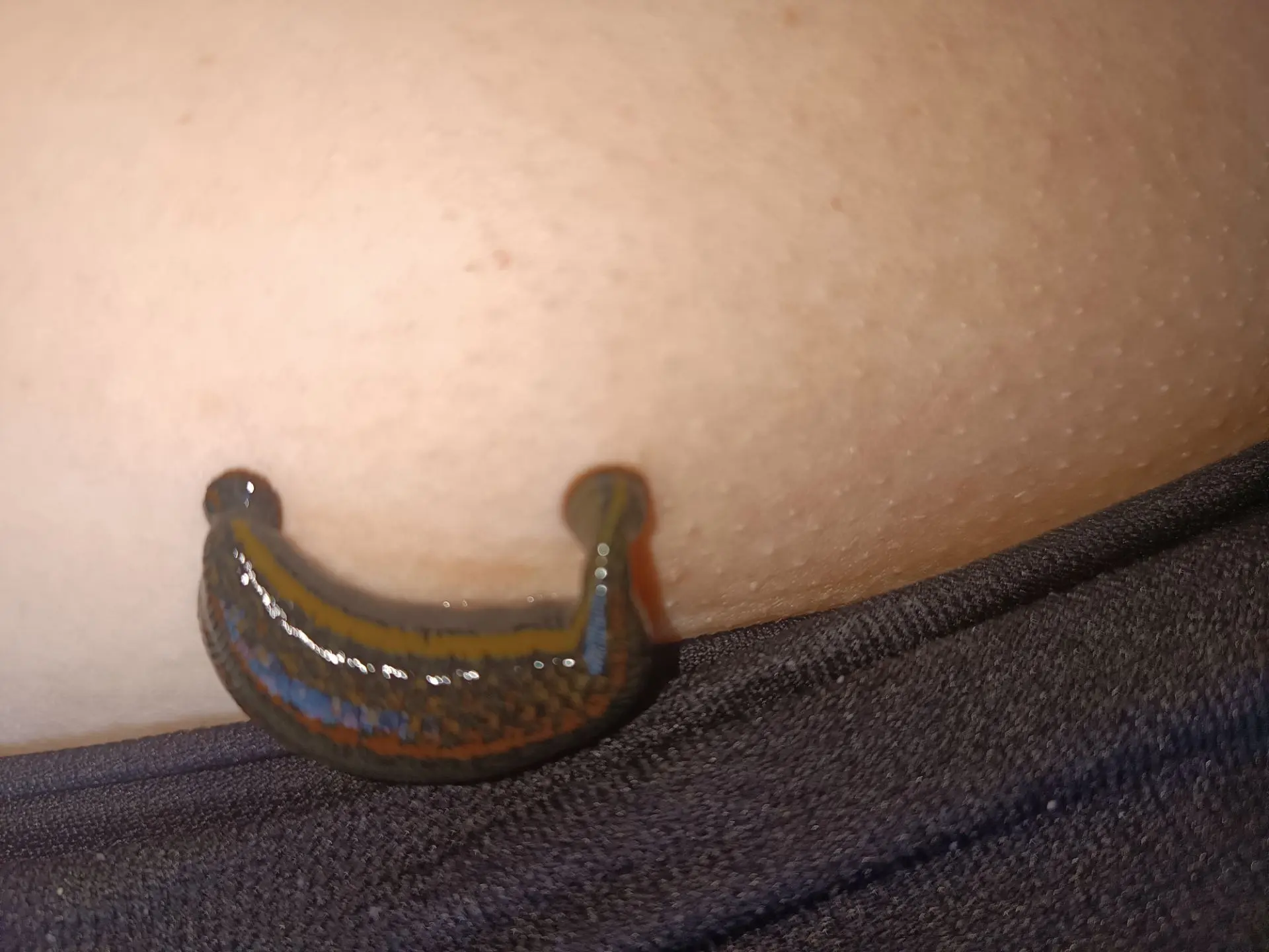 Продолжаю курс гирудотерапии. Маленькие доктора делают свою работу. 🐛💚