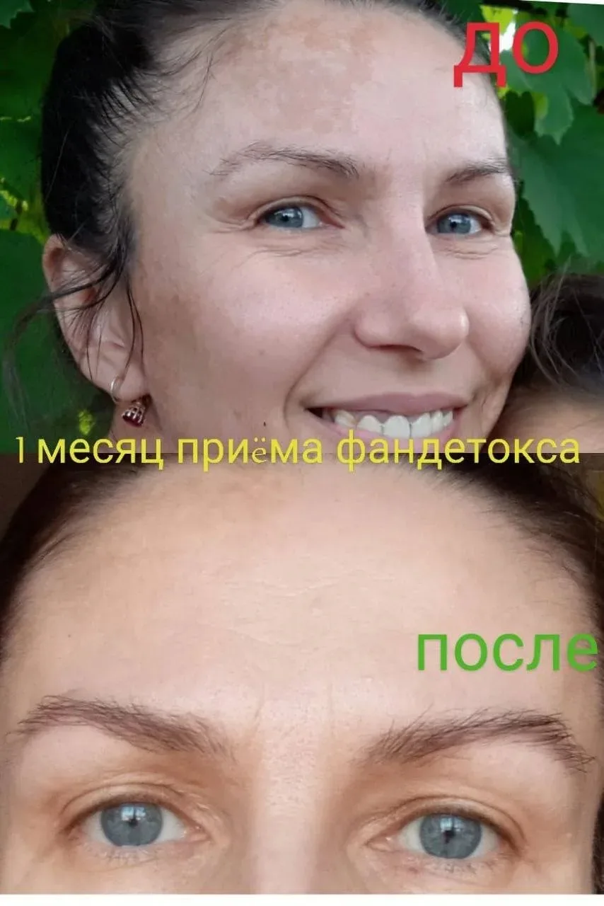 Самые лучшие результаты наших клиентов на приёме программы для очищения печени ФАН ДЕТОКС