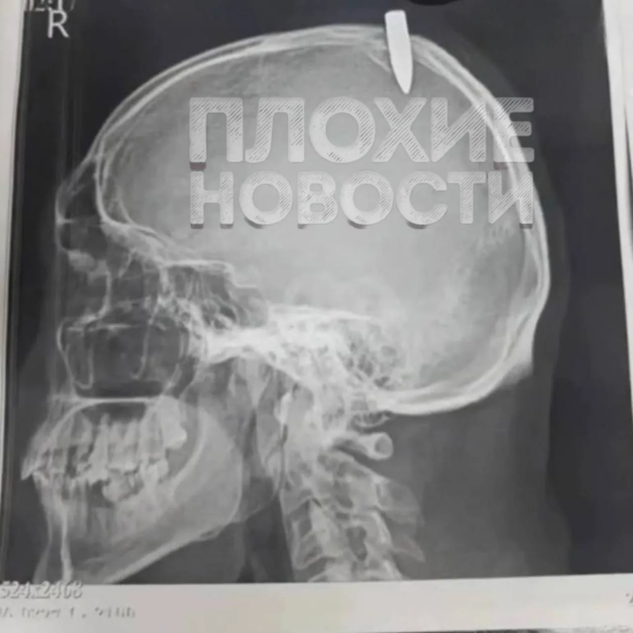 В Красноярском крае во время охоты подстрелили спящего сторожа: пуля попала в голову