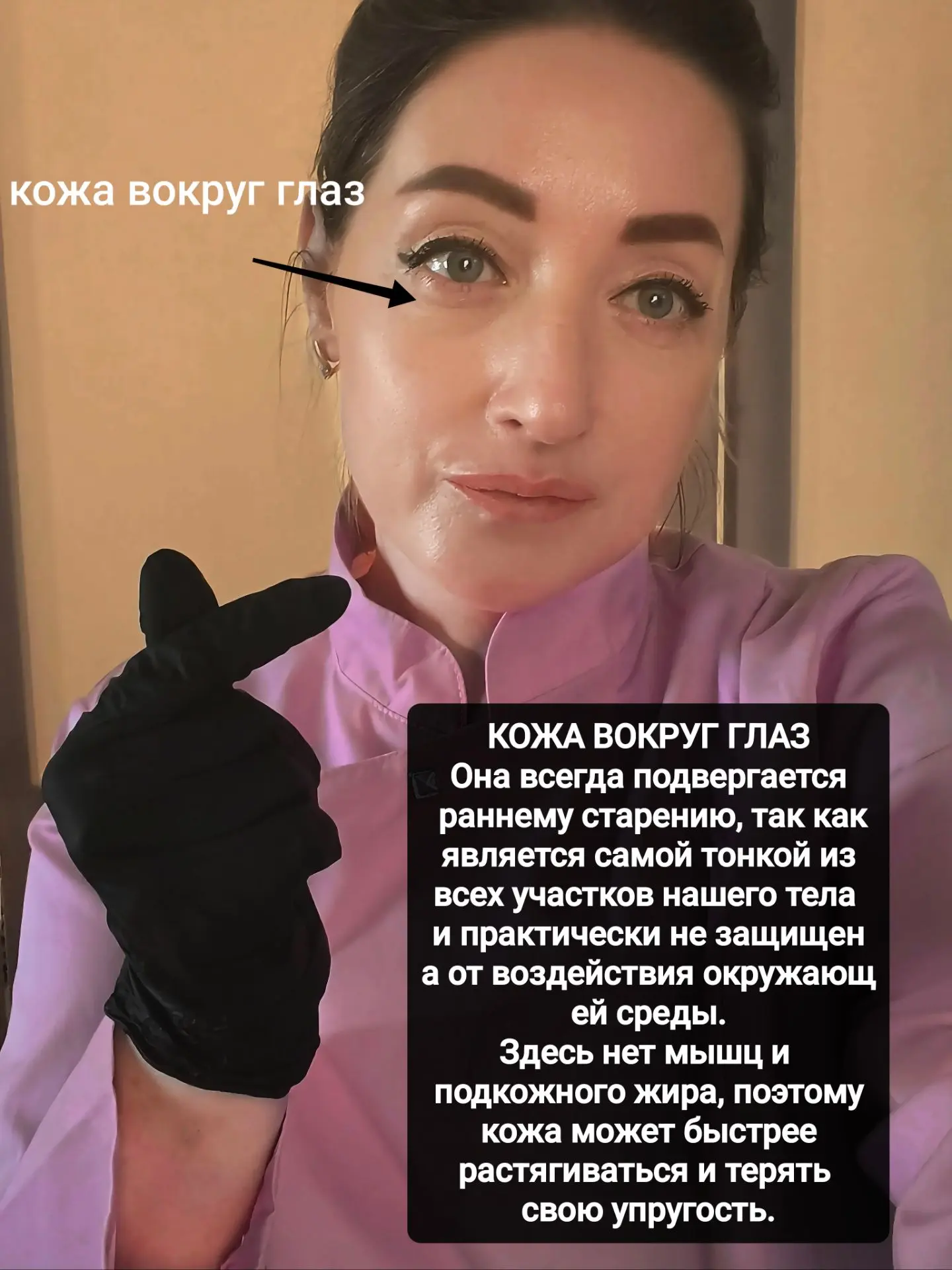 👀КОЖА ВОКРУГ ГЛАЗ