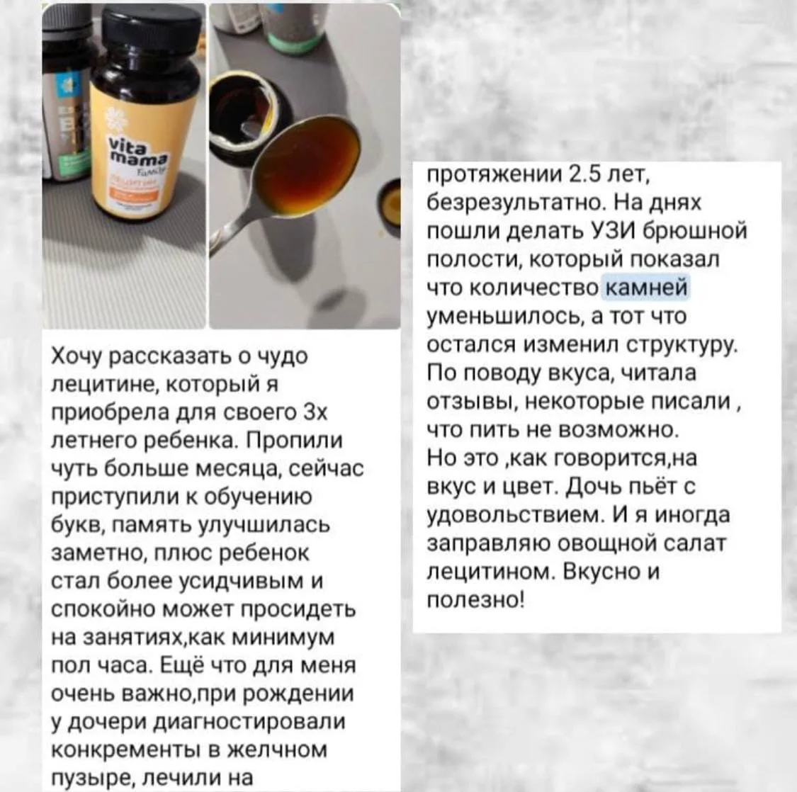 Отзыв о растворении камней в желчном пузыре у ребенка👍