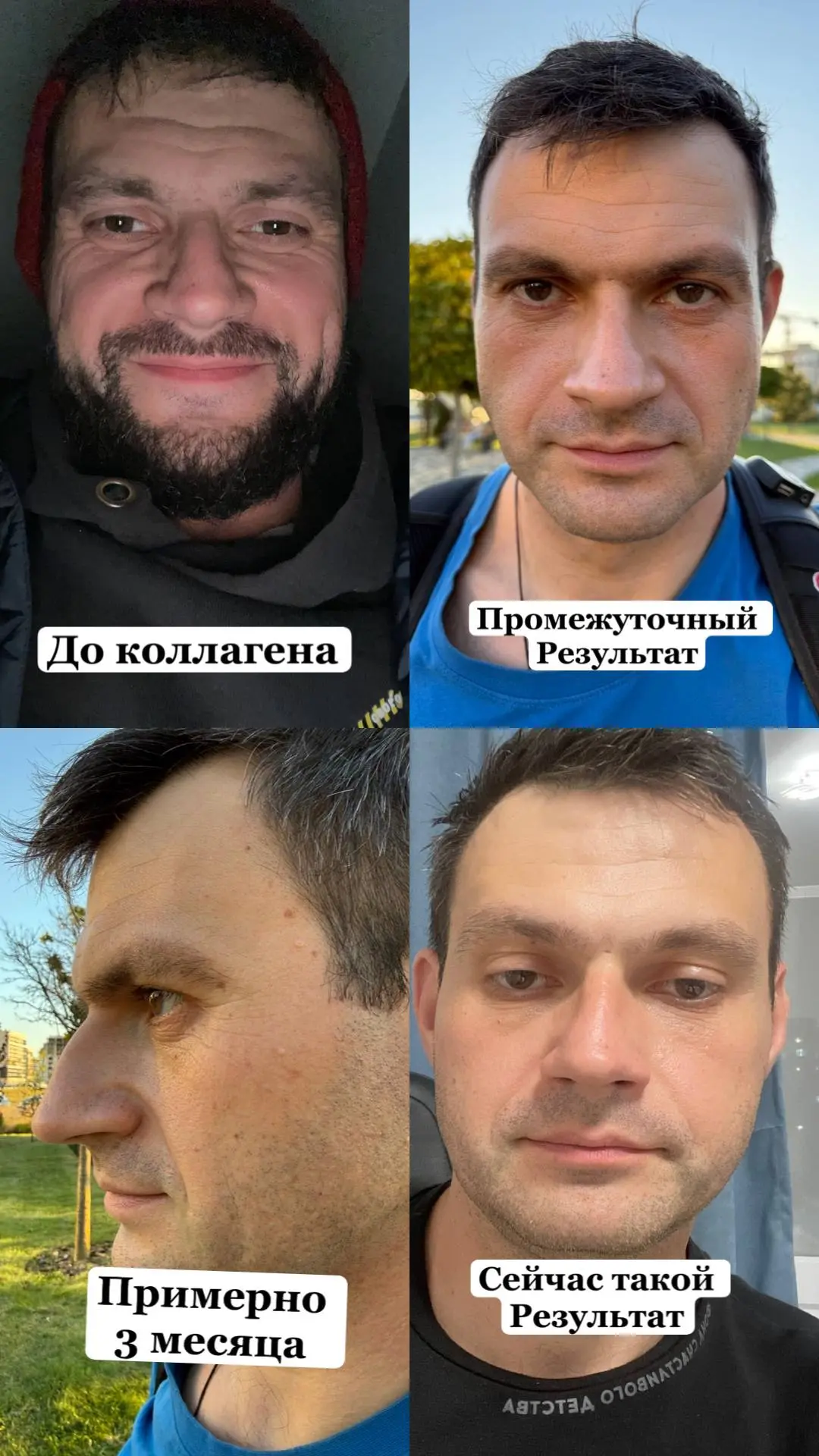 Вот такой мой отзыв о коллагене
