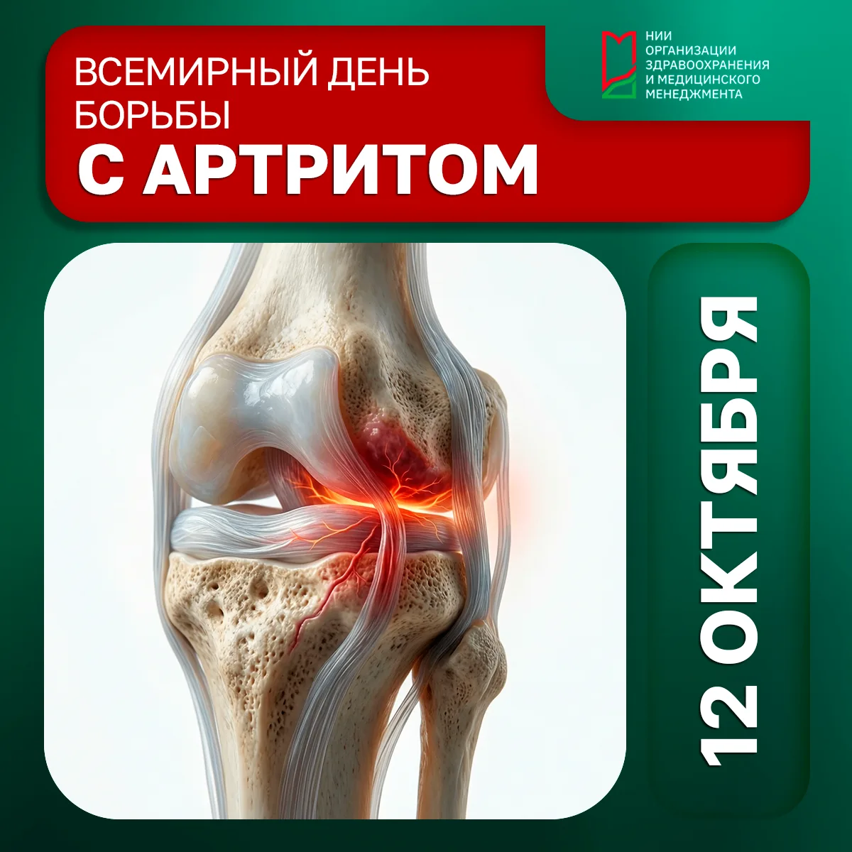 12 октября — Всемирный день борьбы с артритом.